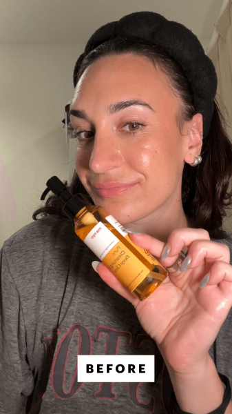 Wohlner before applying the Manyo Pure Cleansing Oil